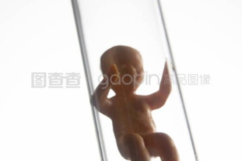 http://zhongshan.nbgk120.com/post/209.html|中山捐卵费用
